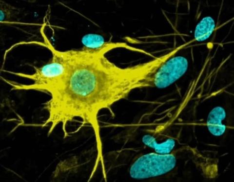 Neural System